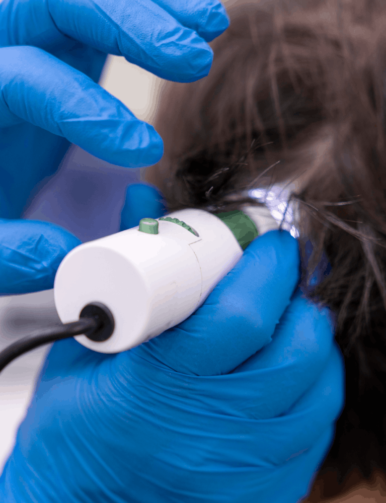 Dermatologist performing Epiglow Scalp Revival Therapy on a patient at a skin and hair clinic in Chennai.