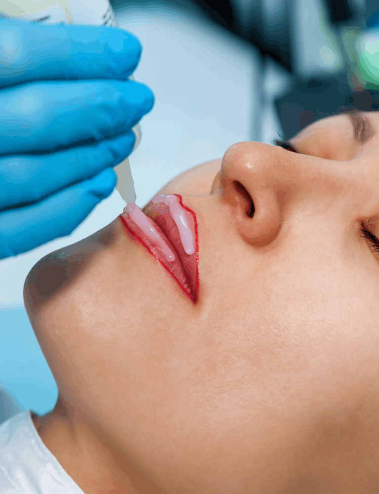 Dermatologist performing lip colour enhancement treatment on a patient at a skin clinic in Chennai.