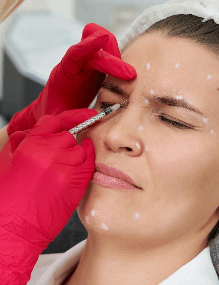 Dermatologist performing tear trough filler treatment to correct under-eye hollowness at a skin clinic in Chennai.
