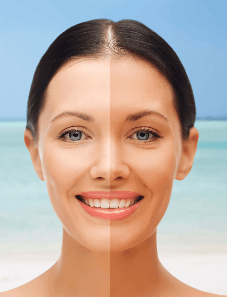 Dermatologist performing sun tan removal treatment on a patient at a skin clinic in Chennai.