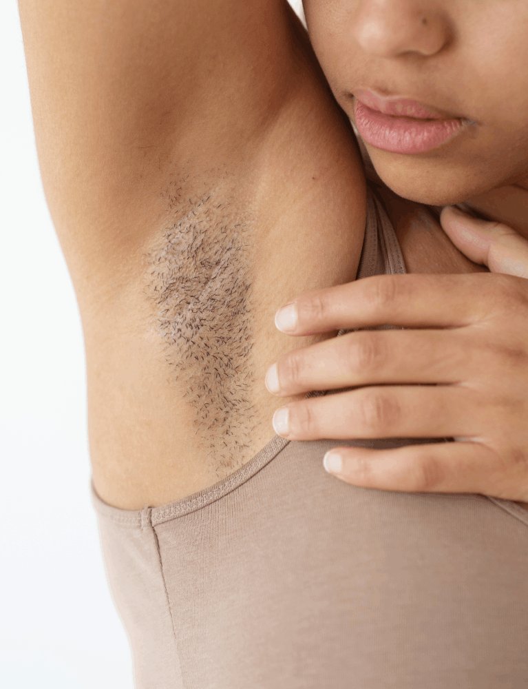 Dermatologist performing underarm pigmentation treatment on a patient at a skin clinic in Chennai.