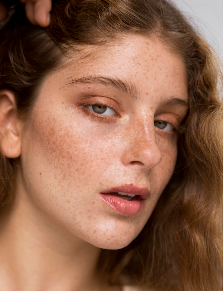 Dermatologist providing Melasma Treatment in Chennai to reduce dark patches, improve skin tone, and restore a clear, even complexion.